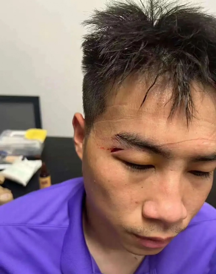 开云APP-津媒：王献钧两颗门牙被撞断，杨帆眉骨受伤赛后去医院缝针